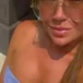 Babesandbotox