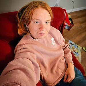 are freckles better in the daylight or by candlelight?🕯️