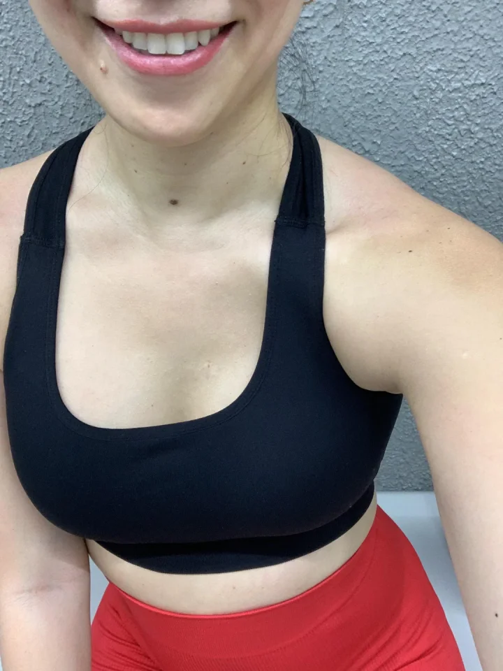 Armpit crease picture of sunny