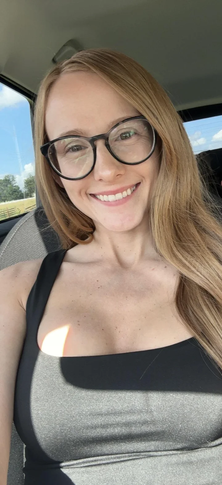 Upper teeth picture of D🖤
