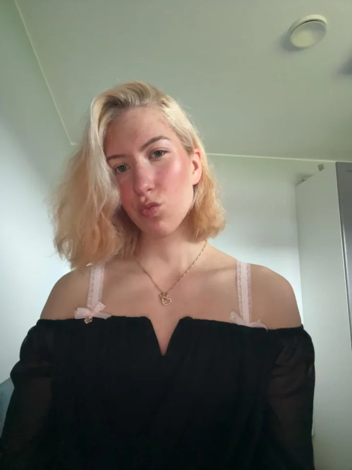 Upper teeth picture of fitnessgirly