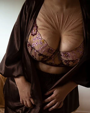 A sun of scars to feed those embroidered flowers