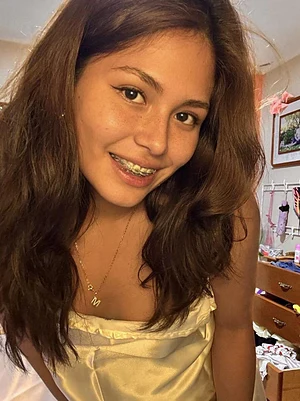 Self conscious about my braces..  do older men like them?