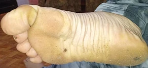 What do you think of my stinky feet?