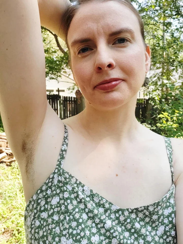 Armpit crease picture of clairabell