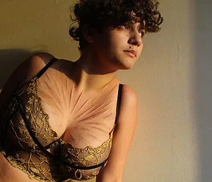 My scars are the prettiest in the sunlight!