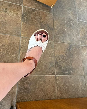 White heels and black toenails