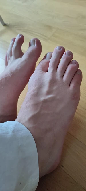 OC do you need these paar?