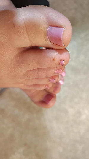 Close up toes😝